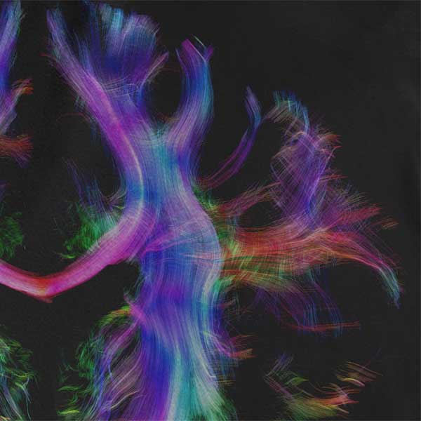 Brain Nerve Fibres Long-Sleeved Unisex T-shirt